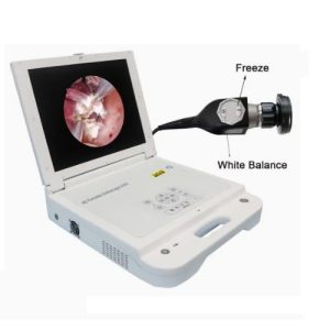 HD Portable Endoscopy Unit  (With recording & Freeze Options)